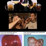 1-L'alcool et la santé ne font pas bon menage (2)